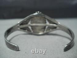 Rare Early Vintage Navajo Dragon's Breath Sterling Silver Bracelet Ring Set